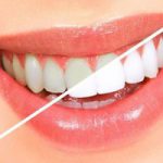 11 اصل برای حفظ سلامت دندان ها سلامت